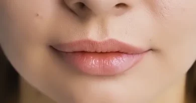 https://www.medicinaesteticacasagrande.it/filler-acido-ialuronico-varese/